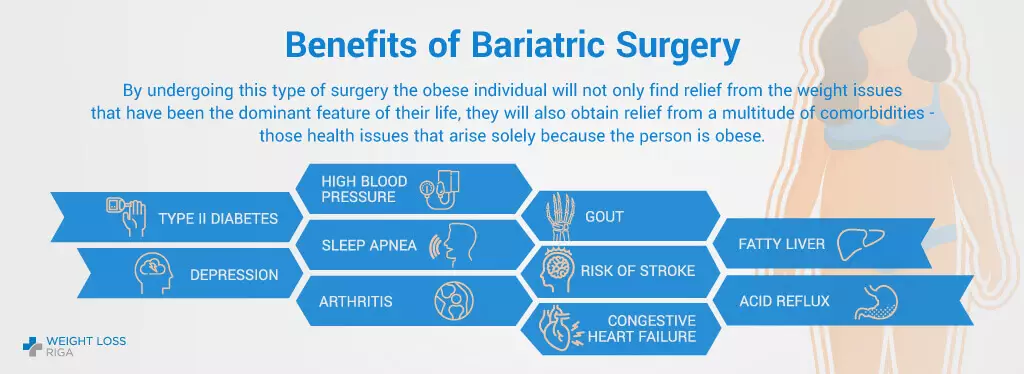 Benefits of Bariatric Surgery Abroad with Weight Loss Riga